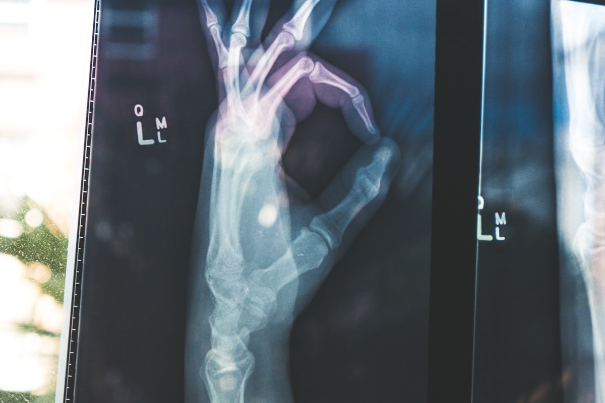 Modified Device, Maximized Safety: Tangdu Hospital's Improved Endovascular Approach to Thoracic Aortic Disease