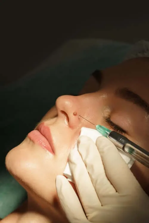Rhinoplasty